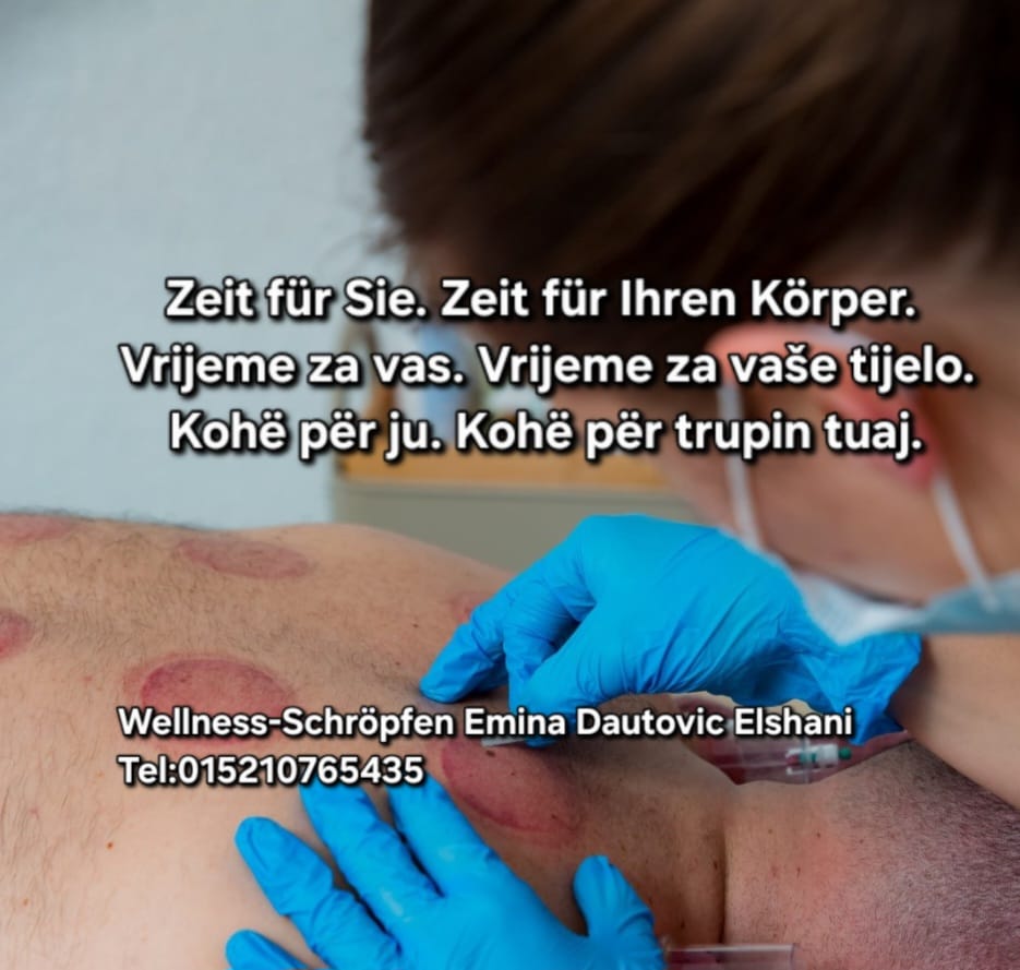 Wellness-Schröpfen / Hijama
