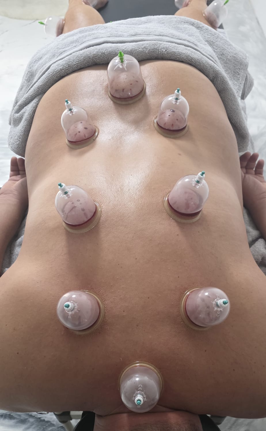 Maderotherapie